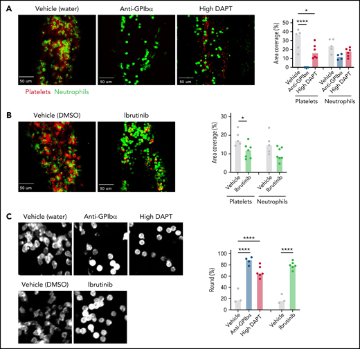 Both platelet GPCR and ITAM receptor signaling contribute to PNA formation on the endothelium during VT initiation. WT mice were treated with anti-GPIbα antibodies to deplete circulating platelets, or with high DAPT (A), or ibrutinib (B) and then subjected to saphenous vein ligation. Spinning disk confocal intravital microscopy was used to visualize platelet (anti-GPIX antibody, red) and neutrophil (anti-Ly6G antibody, green) adhesion to the saphenous vein wall. Representative still frames from the videos taken after 2 hours of flow restriction and quantification of the area covered by platelets or neutrophils are shown. Dots represent individual mice, bars indicate medians. (C) Left panel: higher magnification images illustrating altered morphology of adherent neutrophils in mice treated with anti-GPIbα antibodies, high DAPT, or ibrutinib. Right panel: Quantification of percent round cells in selected fields of view. Dots represent individual mice, bars indicate medians. *P < .05, ****P < .0001.