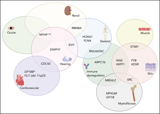 Complex Venn diagram showing the extrahematopoietic manifestations of select germline inherited thrombocytopenia syndromes. *The role of GP1BB in the thrombocytopenia associated with 22q11 del has been recently disputed (see Zwifelhofer et al42).