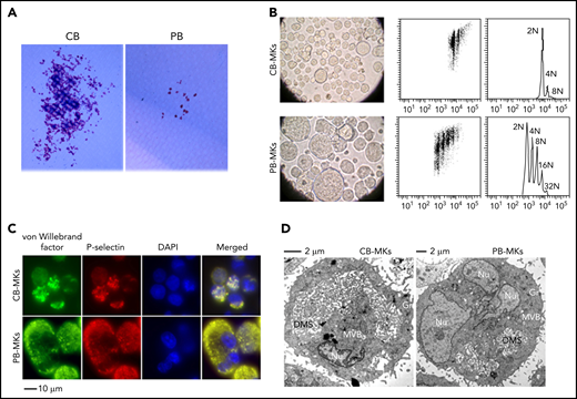 Key features of neonatal megakaryopoiesis. (A) Hematopoietic progenitors from full-term CB or adult PB were cultured in a collagen-based semisolid culture medium (Megacult; StemCell Technologies, Burnaby BC, Canada) in the presence of TPO only. MK colonies generated from CB progenitors were significantly larger than those generated from adult PB. Photomicrographs were taken at a magnification of 200x. (B) CD34+ cells from CB and PB were cultured in a serum-free liquid culture medium with 50 ng/mL of recombinant human TPO as the only growth factor. MKs were evaluated after a 14-day culture period. Representative photomicrographs and ploidy levels by flow cytometry of CB- and PB-MKs demonstrated the smaller size and lower ploidy levels of CB-MKs. Both pictures were taken at a magnification of ×600. (C) Despite their small size, cultured CB-MKs exhibit abundant α-granules containing von Willebrand factor and P-selectin. (D) Flow sorted 2N/4N CB-MKs (left) contain abundant granules (Gr) and a well-developed demarcation membrane system (DMS), consistent with mature MKs and similar to flow-sorted PB MKs with ploidy ≥8N (right). Adapted from Liu et al28 and Davenport et al.114