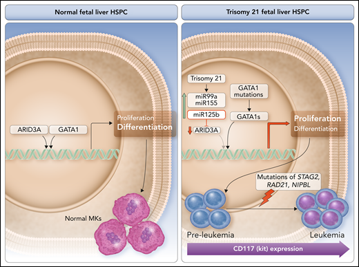 Schematic of the combined effects of trisomy 21 and GATA-1s mutations on the pathogenesis of DS-TMD (preleukemia) and the progression to leukemia. Left panel, in normal FL HSPCs, the transcription factor ARID3A functionally cooperates with full length GATA 1 to induce normal MK proliferation and differentiation. Right panel, in FL HSCs isolated from fetuses with trisomy 21 (T21), 3 chromosome 21 miRNAs are upregulated: miR-99a, miR-155, and miR-125b. The elevated miR125b levels posttranscriptionally repress ARID3A. The combination of low ARID3A levels and GATA-1s in T21 fetuses carrying GATA1s mutations leads to MK hyperproliferation and maturational arrest, which characterize DS-TMD (preleukemia). The progression from preleukemia to leukemia requires additional mutations, most frequently in the cohesin genes STAG2, RAD21, and NIPBL. CD117 (KIT) is a marker of the cells that mediate the propagation of GATA1s-induced preleukemia and GATA1s/STAG2ko-induced leukemia. ARID3A and CD117 (KIT) are potential therapeutic targets for DS-TMD and to avoid the progression to leukemia. Professional illustration by Somersault 18:24.