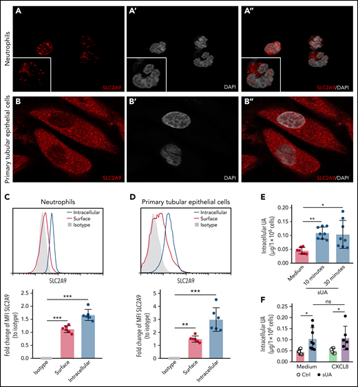Intracellular uptake of uric acid via the urate transporter SLC2A9 in neutrophils. (A-B) Human neutrophils from healthy subjects (A, A’, and A’’) and primary human TECs (B, B’, and B’’) were stained with the anti-human SLC2A9 antibody (red) and DAPI (white, nuclei), and confocal microscopy was performed. (C-D) MFI of intracellular and surface SLC2A9 expression in human neutrophils (C) and TECs (D) compared with isotype control was determined by flow cytometry (n = 3 per group). (E) Neutrophils from healthy subjects were cultured with or without 10 mg/dL sUA for 10 and 30 minutes and the intracellular UA levels determined using an UA assay kit (n = 7-8 per group). (F) Intracellular UA levels from CXCL8-activated neutrophils in the presence or absence of 10 mg/dL sUA determined by UA assay kit (n = 6-8 per group). Data are mean plus or minus SD. *P < .05, **P < .01, ***P < .001. ns, not significant by 1-way ANOVA; DAPI, 4′,6-diamidino-2-phenylindole.