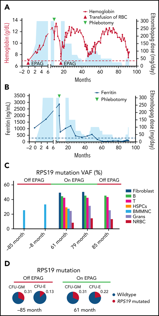 Clinical and molecular analyses of a patient with RSP19 mosaic DBA. (A) Hemoglobin level (left y-axis) is plotted as a function of time in months from eltrombopag initiation to present. Blue shading indicates dosing of eltrombopag (right y-axis). Red triangles indicate RBC transfusions; green triangle indicates a single therapeutic phlebotomy for iron removal (ferritin was 2985 mcg/L, see panel B). (B) Ferritin (left y-axis) is plotted as a function of time from eltrombopag initiation to present. Blue shading indicates dosing of eltrombopag (right y-axis). (C) Fraction of mutant alleles (RPS19 c.356 + 3A>C) in cultured skin fibroblasts, bone marrow mononuclear cells, and marrow subpopulations measured by digital droplet PCR at different time points in months in relation to eltrombopag initiation. (D) Fraction of mutant allele of granulocyte–macrophage and erythrocyte colony-forming unit (CFU-GM and CFU-E) grown from the patient’s bone marrow before and on treatment with eltrombopag. All CFUs were wild-type or heterozygous-mutated. Grans, granulocytes; NRBC, nucleated red blood cells; RBC, red blood cells.