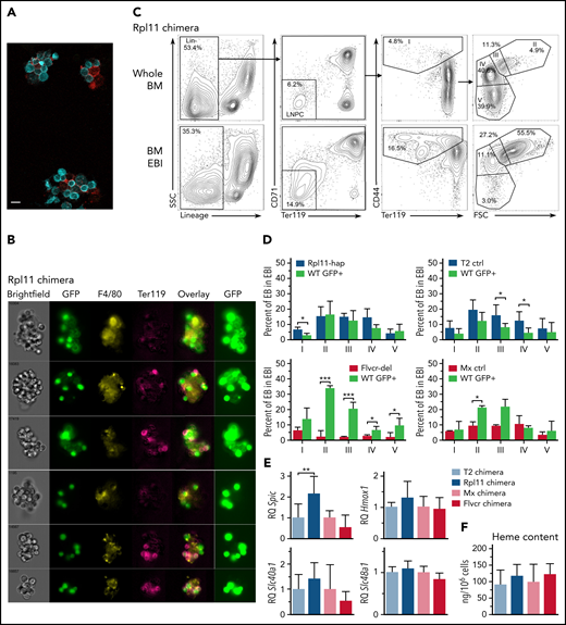 RPL11 haploinsufficient cells prevent expansion of normal erythroid cells on erythroblastic islands. (A) Photomicrograph of 3 erythroblastic islands (EBIs) from wild-type C57Bl/6J mice. Ter119+ cells are in cyan; F4/80+ macrophages are in red. The indicator bar is 10 μM. (B) Representative ImageStream flow cytometry analysis of enriched bone marrow EBI from a 50:50 Rpl11 chimeric transplant mouse showing both GFP+ and Rpl11 haploinsufficient (GFP–) Ter119+ erythroid cells attached within the same EBIs. GFP is overexposed in the panels on the right to aid in resolution of whether the macrophages express GFP or not because macrophage GFP is difficult to detect compared with the very high erythroid GFP expression. The top 3 EBI panels contain GFP+ macrophages. About 2/3 of the imaged EBIs included GFP+ (therefore control WT) macrophages. Of 18 EBIs examined from Rpl11-chimeras, all contained both GFP+ and GFP– Ter119+ erythroid precursors. ImageStream analysis of T2 control and Flvcr-chimeras are in supplemental Figure 4. (C) Representative flow cytometry analysis of mouse bone marrow erythroid precursor cells from a 50:50 Rpl11-chimeric transplant mouse before (whole BM) and after enrichment for erythroblastic islands (BM EBI). Cells are gated to identify BFU-E through reticulocytes as before.13 Gating includes lineage-negative precursors (LNPC), erythroid precursor population I includes BFU-E, CFU-E, and proerythroblasts, whereas populations II-V are basophilic, polychromatic, orthochromatic erythroblasts, and reticulocytes, respectively. The isolated EBIs included between 6.6% and 12.8% of the total marrow mononuclear cells recovered from whole marrow in the chimeric mice. Representative flow analysis of T2 control and Flvcr-chimeras are in supplemental Figure 5. (D) Erythroid precursor cell composition of EBIs isolated from 50:50 chimeras. Rpl11-hap:GFP (N = 3), T2 control:GFP (N = 6), Flvcr-del:GFP (N = 4), and Mx control:GFP (N = 2) mice showing the percentage of cre+ control or mutant erythroblast cells along with the percentage of GFP+ partner cells in each population stage (I-V) of erythroid differentiation in EBI isolated from marrow. (E) Quantitative PCR analysis showing relative expression of heme induced genes Spic, Hmox1, Slc40a1 (ferroportin), and Slc48a1 (HRG1) in F4/80+ EBI macrophages isolated from 50:50 chimeric transplant mice (Rpl11 and T2 control chimeras, N = 5 mice; Flvcr and Mx control chimeras, N = 3 mice). The cre control or mutant F4/80+ macrophages (GFP– and their wild-type (GFP+) chimeric partner F4/80+ macrophages were sorted separately and analyzed as technical replicates to eliminate potential bias from unequal prevalence. (F) Heme content in WT/GFP+ polychromatic erythroblasts (population III) isolated from EBI of chimeric mice (N = 3-8 mice). Data are presented as mean ± standard deviation. *P < .05; **P < .01; ***P < .001 from Student t test. BFU-E, burst-forming unit–erythroid; BM, bone marrow.
