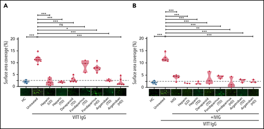 Impact of anticoagulants on VITT–IgG-mediated platelet adhesion/thrombus formation. (A) Platelets from healthy individuals were incubated with IgGs from healthy controls (HCs) or VITT patients before calcein staining and reconstitution with autologous whole blood and perfusion through BioFlux microfluidic channels. IgG concentrations were measured using nanodrop (mean IgG concentration, 15.10 ± 2.14 mg/mL). Where indicated, samples were treated with different concentrations of anticoagulants: low-dose heparin (0.1 U/mL), therapeutic-dose heparin (0.5 U/mL), TD danaparoid (0.8 U/mL), TD and HD fondaparinux (1 and 8 µg/mL), and TD and HD of argatroban (0.8 and 8 µg/mL). (B) IVIG was added alone or in combination with anticoagulants. Each dot represents 1 VITT patient IgG. Images were acquired at 20× magnification using an inverted Olympus IX73 or Zeiss Axio Observer 7 fluorescence microscope. Thrombus formation was determined as the %SAC by adherent platelets using ImageJ. Images were processed identically using automated or manually adjusted threshold settings and exclusion of image artifacts. Violin plots showing the distribution of the values were generated using Graphpad Prism 8. This figure represents values from the same experimental setup. The figure is split into 2 different panels (1A and 1B) for easier interpretation of the results. Therefore values and representative images in the HCs group and some in untreated VITT IgGs are presented in both panels. HD, high dose; LD, low dose; ns, not significant; TD, therapeutic dose. *P < .05, **P < .01, and ***P < .001.
