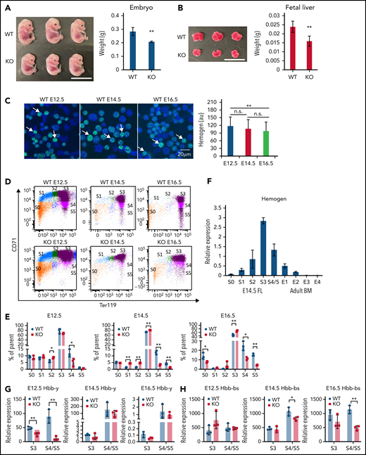 Maturational defect in erythropoiesis and reduction of globin transcription in Hemgn−/− mice.Hemgn−/− mouse E14.5 embryos (A) and livers (B) are smaller in size compared with control littermates. Scale bars, 1 cm. (C) Immunofluorescence indicating that hemogen protein is downregulated during fetal development (E12.5-E16.5) (white arrows). Quantification of hemogen fluorescence intensity in 25 cells (right panel). (D) Flow cytometry with Ter119 (glycophorin A, GYPA) and CD71 (transferrin receptor) staining to separate maturational stages S0-S5 fetal liver cells of Hemgn−/− mice and WT littermates. (E) Quantification of cell numbers in populations S0-S5 in (D). (F) Relative expression level of hemogen to actin in the S0-S5 population of E14.5 fetal liver (FL) and E1-E4 population of bone marrow (BM) cells. Reverse transcription quantitative PCR (RT-qPCR)showing expression of embryonic Hbb-y and adult Hbb-bs in fetal liver cell populations S3 and S4/5 at E12.5, E14.5, and E16.5. Error bars represent standard deviation. N = 3 biological replicates. *P < .05, **P < .01, 2-tailed Student t test. au, arbitrary units.