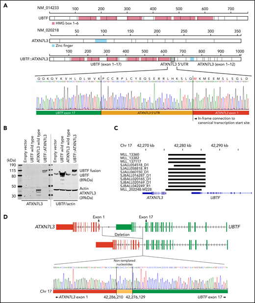 Detection of novel UBTF::ATXN7L3 fusion gene. (A) Protein structures of wild-type UBTF, ATXN7L3, and UBTF::ATXN7L3 fusion (exon 17 type) are shown. UBTF exon 17 is rearranged to the 5′ untranslated region (UTR) of ATXN7L3 and encodes an in-frame chimeric fusion protein. Direct sequencing of a representative case (SJALL060150) is shown. (B) Immunoblotting showing wild-type UBTF (right second lane), ATXN7L3 (left third lane), and UBTF::ATXN7L3 fusion (exon 17 type, 4th lane) proteins. Protein lysate was collected from human embryonic kidney 293T cells with transient transfection of wild-type UBTF and ATXN7L3, and UBTF::ATXN7L3 fusion containing plasmids. All samples were run in the same gel. After transferring, the membrane was cut, probed with 2 different antibodies, and then the 2 halves scanned together. (C) The deleted UBTF regions detected by WGS are shown in black bars. (D) The schema of UBTF deletion and direct sequencing of a representative case (SJBALL020169) is shown. Nontemplated nucleotides are inserted at the breakpoint.