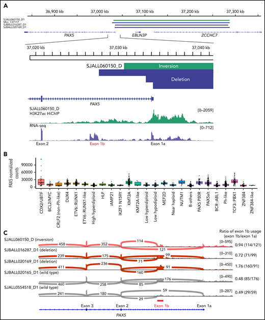 PAX5 deregulation in a subset of CDX2/UBTF subtype induced by the structural variants at PAX5-ZCCHC7 region. (A) The SVs at PAX5/ZCCHC7 region detected by WGS were shown in green (inversion) and blue (deletion) bars. Below the coverage tracks of 1-dimensional HiChIP and RNA-seq for representative CDX2/UBTF inversion case (SJALL060150_D) are shown. SVs include the promoter and exon 1 of PAX5 (exon 1a) but do not affect the alternative PAX5 exon 1b. (B) Expression of PAX5 by normalized read counts in each B-ALL subtype is shown. CDX2/UBTF cases with PAX5 rearrangements are shown in green (inversion) and blue (deletion). PAX5 is expressed highly in CDX2/UBTF subtype, especially for the case with PAX5/ZCCHC7 inversion. (C) Sashimi plot showing the junctions with the number of reads split across the junction (junction depth) in the PAX5 gene for representative CDX2/UBTF samples: inversion (n = 1, SJALL060150_D), deletion (n = 2, SJBALL016287_D1 and SJBALL020169_D1), and without PAX5 rearrangements (n = 2, SJBALL020165_D1 and SJALL0554518_D1). PAX5 exon 1b is shown in red bar. The ratio of exon 1b usage to exon 1a is shown in the right of plot. The cases with PAX5 rearrangements exhibited higher exon 1b usage ratio than cases without rearrangements.