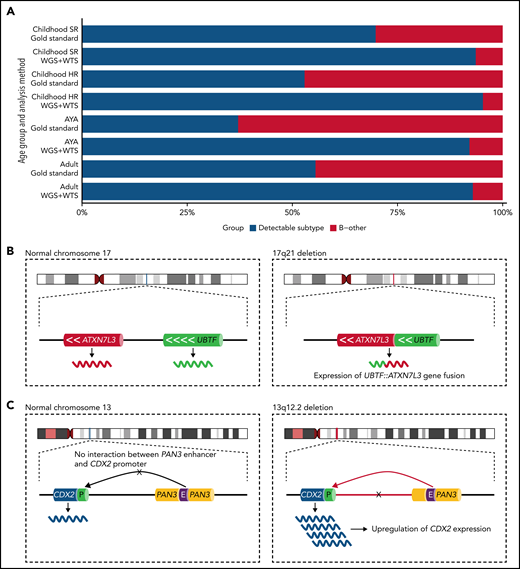 The frequency of B-other in different age groups of B-ALL and the genetic rearrangements characterizing the newly described UBTF/CDX2 ALL subtype. (A) An estimate of the fraction of B-ALL cases harboring a subtype-specific genetic alteration and those with an unknown genetic cause (B-other) when assessed by gold-standard methods or WGS and WTS. Gold-standard diagnostics typically include chromosome banding, fluorescence in situ hybridization (FISH), and targeted molecular tests. About 20% of the Philadelphia-like B-ALL subtype was estimated to be detectable indirectly by FISH. Frequency estimates were inferred from Gu et al and Kimura et al.5,6 (B, left) The localization of the UBTF and ATXNL3 genes at 17q21 are schematically depicted. (right) A focal 10-kb genomic results in an in-frame UBTF::ATXN7L3 gene fusion at the breakpoint junction. (C, left) Schematic depiction of 13q12.2 in which the CDX2 gene is located ∼280 kb away from the active PAN3 gene enhancer. (right) A focal genomic deletion causes an aberrant chromatin looping configuration by which an active enhancer of the PAN3 gene is retargeted (“hijacked”) and starts driving the ectopic expression of the CDX2 gene. AYA, adolescents and young adults; HR, high risk; SR, standard risk.