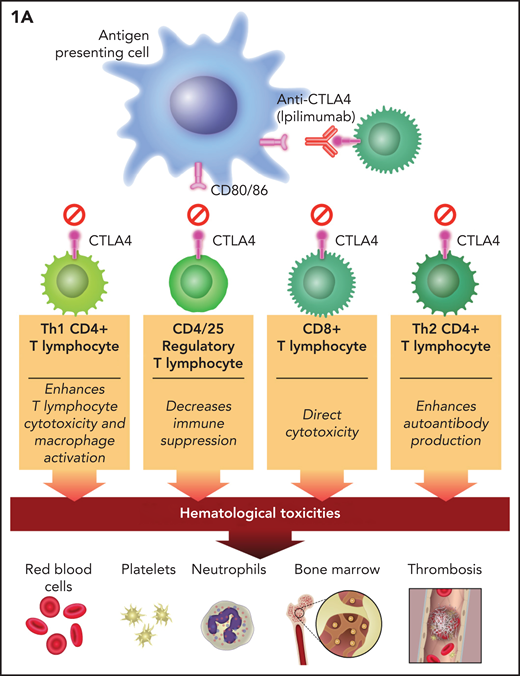 Putative mechanisms of immune checkpoint inhibitor–associated hematologic toxicities. Anti–CTLA-4 therapy blocks inhibitory signals to cytotoxic (CD8+) and helper (Th1 and Th2) T lymphocytes and suppresses the activation of Tregs (CD4+ and CD25+). (B) PD-1/PD-L1 therapies have identical effects plus they block inhibitory signals to B lymphocytes, NK cells, and macrophages. The direct effects on T-lymphocyte classes and subclasses unleash cytotoxicity. These effects plus the indirect (CTLA-4 inhibition unleashing Th2CD4+ lymphocytes) and direct (anti–PD-1 and anti–PD-L1) effect on B lymphocytes leads to autoantibody production. CD8+ T-lymphocyte cytotoxicity and B-cell synthesis of autoantibodies are putative mechanisms of ICI-associated anemia, thrombocytopenia, neutropenia, and bone marrow failure. PD-1 and PD-L1 blockers that unleash NK cells could also result in direct bone marrow cytotoxicity. The direct effect of PD-1 and PD-L1 blockers on macrophage activity and the indirect effect of CTLA-4 blockade on unleashing Th1CD4+ and CD8+ T lymphocytes to stimulate macrophages could result in excessive cytokine production allegedly mediating HLH (IL-6) and VTE (IL-8).