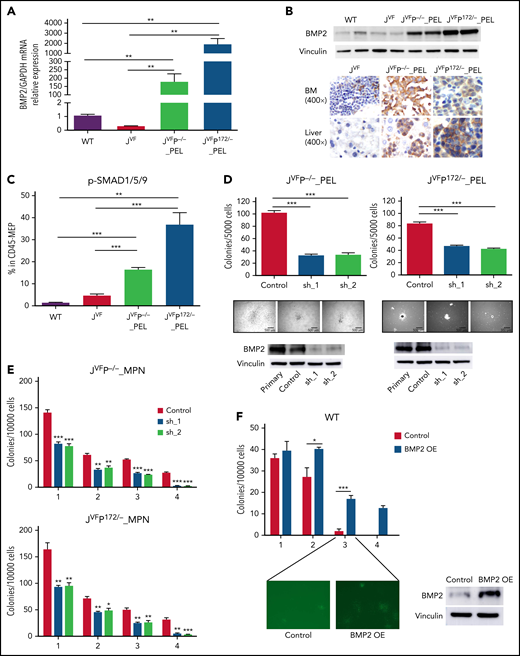 BMP2/SMAD pathway is upregulated in erythroleukemic blasts and contributes to proliferation and self-renewal. (A) Quantitative reverse transcription polymerase chain reaction for Bmp2 in MEPs from WT, JVF, PEL JVFP−/−, and PEL JVFP172/– mice (n = 5-6 mice per genotype). JVFP−/− vs WT, P = .0064; JVFP−/− vs JVF, P = .0062; JVFP172/– vs WT, P = .007; JVFP172/– vs JVF, P = .007. (B) Western blot (top) for BMP2 in c-kit+ spleen cells (side-by side duplicates for each murine genotype are presented) and immunohistochemistry (IHC) (bottom) for BMP2 in BM and liver. Magnification, 400×. (C) The fraction of pSMAD1/5/9–positive cells within CD45-MEPs measured by flow cytometry in WT (n = 4), JVF (n = 11), PEL JVFP−/− (n = 12), and PEL JVFP172/– mice (n = 10). JVFP−/− vs JVF, P < .0001; JVFP172/– vs JVF, P < .0001. (D) Top: total number of colony-forming units (CFUs) generated by JVFP−/− and JVFP172/– erythroleukemic blasts (Lin–CD45–c-Kit+ spleen cells) containing sh. Control (Control), sh.Bmp2_1 (sh_1), and sh. Bmp2_2 (sh_2) (n = 4 for each group). JVFP−/−: sh_1 vs Control, P < .0001; sh_2 vs Control, P < .0001. JVFP172/–: sh_1 vs Control, P < .0001; sh_2 vs Control P < .0001. Middle: representative colonies from each group (magnification, 25×). Bottom: western blot for BMP2 in erythroleukemic blasts with and without Bmp2 knock down. (E) Methylcellulose replating assay for MPN JVFP−/− and JVFP172/– c-Kit+ BM cells containing sh. Control (Control), sh. Bmp2_1 (sh_1), and sh. Bmp2_2 (sh_2) (n = 4 for each group). For the first platting, 10 000 GFP+c-Kit+ cells were plated per well. For the second platting and beyond, cells from the prior platting were used for replating (10 000 cells per well). (F) Top: Methylcellulose replating assay for Bmp2-overexpressed (OE) in WT BM c-Kit+ cells (n = 4 for each group). For the first platting, 10 000 GFP+c-Kit+ cells were plated per well. For the second platting and beyond, cells from the prior platting were used for replating (10 000 cells per well). Second platting, P = .029; third platting, P = .0004. Bottom left: Representative CFUs in third round of replating (magnification, 25×). Bottom right: western blot for BMP2 in WT c-Kit+ cells with and without Bmp2 overexpression. (G) PB counts of recipients transplanted with JVFP−/− erythroleukemic blasts transduced with sh. Control (Control), sh. Bmp2_1 (sh_1), and sh. Bmp2_2 (sh_2) three weeks after transplantation. N = 4 to 5 mice per arm. White blood cell (WBC): sh_1 vs Control, P = .0214; sh_2 vs Control, P = .0059. HGB: sh_1 vs Control, P = .0101; sh_2 vs Control, P = .0105. (H) Percentage of GFP+ cells of PB in recipients transplanted with JVFP−/− erythroleukemic blasts transduced with sh. Control (Control), sh. Bmp2_1 (sh_1), and sh. Bmp2_2 (sh_2) three weeks after transplantation. N = 4 to 5 mice per arm. sh_1 vs Control, P = .001; sh_2 vs Control, P = .0005. (I) Kaplan-Meier survival analysis of recipients transplanted with JVFP−/− erythroleukemic blasts transduced with sh. Control (Control), sh. Bmp2_1 (sh_1), and sh. Bmp2_2 (sh_2). P value was determined by the log-rank test. N = 4 to 5 mice per arm. sh_1 vs Control, P = .0145; sh_2 vs Control, P = .0035. (J) Histogram representation of BMP2, SMAD1, SMAD5, ID1, and BMPR2 gene expression in 14 post-MPN AML cases (including 3 post-MPN M6 and M7) and 9 cases of polycythemia vera (PV). The false discovery rate (FDR)-adjusted P values were calculated by DESeq2. Data are represented as mean ± standard error of the mean (SEM). The unpaired t test was used to compare the mean of 2 groups in panels A, C, D, E, F, G, and H. *P < .05, **P ≤ .01, ***P ≤ .001.