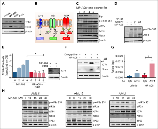 MP-A08 induces ATF4 dependent Noxa transcription. (A) MV411 cells were treated with MP-A08 (20 μM), daunorubicin (DNR) (1 μM), or cytarabine (Ara-C; 1 μM) for 6 hours; lysed; and subjected to immunoblot analysis with the indicated antibodies. (B) The UPR. (C) MV411 cells were treated with MP-A08 (20 μM) over a 6-hour period, lysed, and subjected to immunoblot analysis with the indicated antibodies. (D) MV411 cells were stably transduced with 2 different CRISPR guide sequences targeting SPHK1 (g1 and g2), lysed, and subjected to immunoblot analysis with the indicated antibodies. The efficiency of the SPHK1 knockout was confirmed via SPHK1 activity assays of lysates from those cells in assay conditions largely selective for SPHK1 over SPHK2 (supplemental Figure 5C). (E) MV411 cells were treated with MP-A08 (20 μM), alone or in combination with the eIF2b agonist, ISRIB (200 nM) over 6 hours for quantitative polymerase chain reaction analysis of Noxa messenger RNA levels and immunoblot analysis with the indicated antibodies. Statistical significance was assessed by Student t test. *P < .05 (n = 3). (F) MV411 cells were stably transduced with a doxycycline-inducible shRNA targeting ATF4. Cells were treated with 1 μg/mL doxycycline for 48 hours and MP-A08 (20 μM) for 6 hours before cell lysis for immunoblot analysis. ns, a nonspecific band. (G) Chromatin immunoprecipitation analysis of the Noxa promoter in response to MP-A08 treatment (20 μM) of MV411 cells for 6 hours. Statistical significance was assessed by Student t test. *P < .05 (n = 4). (H) Primary AML samples were treated with increasing concentrations of MP-A08 and subjected to immunoblot analysis with the indicated antibodies. All qualitative data are representative of at least 3 independent experiments, and all quantitative data represent the mean ± standard error of the mean of at least 3 independent experiments.