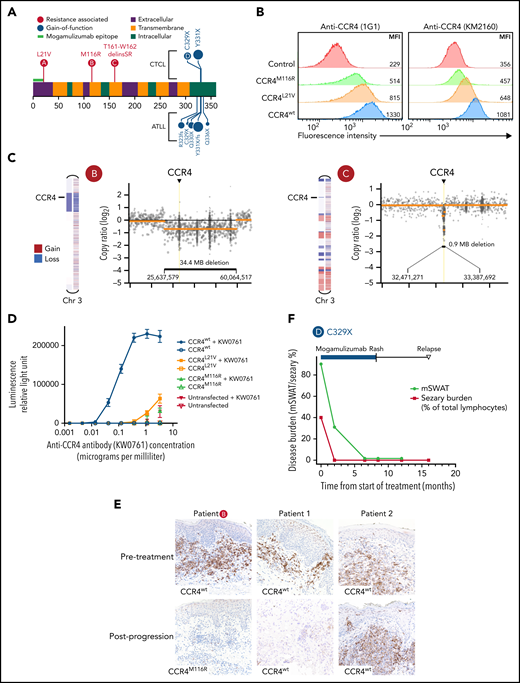 Mutations in CCR4 arising after mogamulizumab treatment result in decreased CCR4 expression and reduced antibody dependent cellular cytotoxicity. (A) Diagram of resistance-associated CCR4 mutations (red circles) in 3 mogamulizumab-treated patients in relation to the mogamulizumab-binding epitope, transmembrane domains, and previously described GoF mutations (blue circles). (B) Jurkat cells were transfected with either CCR4wt, CCR4M116R, or CCR4L21V. MFI of CCR4 by flow cytometry is shown using 2 CCR4 antibodies: 1G1 (left) and KM2160 (right). (C) Normalized copy ratio of reads binned across chromosome 3. Yellow line indicates segmented copy number alterations. (D) Antibody-dependent cellular cytotoxicity assay. Jurkat transfectants were cocultured with a Jurkat reporter cell line expressing FcγRIIIa and firefly luciferase under an NFAT response element. Cells were incubated overnight with or without the human anti-CCR4 antibody KM0761 prior to detection of luciferase activity. Erros bars indicate standard deviation. (E) IHC staining of CCR4 in skin biopsies of 3 patients before (top) and after (both) progression on mogamulizumab. Each row of images represents paired biopsies from the same patient. (F) Response to mogamulizumab in the skin (black) and blood (red) in a patient with Sézary syndrome and a C329X GoF mutation of CCR4.