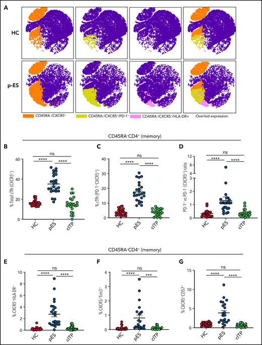 Expansion and activation of cTfh in patients with pES. (A) Representative FItSNE plots showing frequency and activation status of cTfh cells in patient with pES and HC where CD4+ T cells were first manually gated for total memory cells (CD45RA−) and then down-sampled to equal number of cells. CXCR5+ cells were gated on CD45RA−CD4+ T cells and subsequently gated for HLA-DR+ or PD-1+ cells. Expression of cTfh and activation markers on cTfh (ie, PD-1+ and HLA-DR+) are shown in different colors. Overlaid expression of PD-1+, HLA-DR+, and CXCR5+ markers are shown at the extreme right for both HC and pES. (B-C) Plots showing percentage of cTfh as CXCR5+CD45RA−CD4+ T and CXCR5+PD-1+CD45RA−CD4+ T subsets in HCs (n = 24), patients with pES (n = 24), and patients with cITP (n = 22). (D) Plot showing ratio of PD-1+ cTfh vs PD-1− cTfh in HCs, patients with pES, and patients with cITP. (E-G) Percentage of CXCR5+HLA-DR+, CXCR5+Tim3+, and CXCR5+CD57+ expression on total memory CD4+ T cells in different patient groups. Data represent mean ± standard error of the mean (SEM) values for each group. Kruskal-Wallis 1-way analysis of variance (ANOVA) followed by Dunn’s multiple comparison test for nonnormally distributed samples and ordinary 1-way ANOVA followed by Tukey’s multiple comparison test for normally distributed samples were used for statistical comparison. ***P < .001; ****P < .0001; ns, not significant.