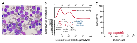 Case 1, AML characterization. (A) Presentation bone marrow aspirate, AML blasts with folded nuclei, prominent nucleoli, and fine chromatin, consistent with FAB subtype M4. The stain is Wright-Giemsa; original magnification is ×1000. (B) Variant allele frequencies (VAFs) of high-coverage-depth (>100×) somatic mutations from the patient's bone marrow plotted against tumor coverage. The kernel density plot (top; a.u., arbitrary units) is suggestive of at least 1 major subclonal population. AML-related mutations are labeled (bottom). The germline DNMT3A mutation is denoted in blue for context. (C) VAFs of the leukemia and remission samples, showing that all leukemic cells were cleared. Only 0.03% of remission sample reads at mutation locations had variant-supporting reads, well within the error rate of the sequencing process.