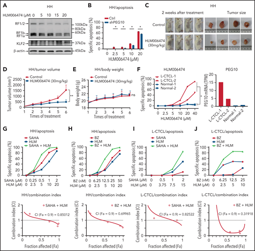 HLM006474 inhibits cell survival and synergizes with HDACi and Pi in vitro and vivo as well as patient-derived CTCL cells. (A) Protein levels of PEG10 and KLF2 in HH cells treated with increasing concentration of HLM006474 for 72 hours. (B) Specific apoptosis of PEG10-suppressed (shPEG10) and control (Ctrl) HH cells under exposure to different-dose HLM006474 for 48 hours. (C) Macroscopic pictures of xenograft tumors after subcutaneously injecting HH cells. Tumor-bearing animals were randomized into 2 groups (n = 4, each) and intraperitoneally injected with either 20% captisol as vehicle control or 30 mg/kg HLM006474 3 times a week for 2 weeks. (D,E) Median tumor volume (D) and body weights (E) in control and treated xenograft mice were measured over treatment times. (F) Specific apoptosis of PBMCs from 2 leukemic CTCL patients (L-CTCL) and healthy donors (Normal) under exposure to increasing concentration of HLM006474 for 24 hours. PEG10 mRNA expression levels (TPM) are shown on the right panel. (G,H) Specific apoptosis and combination index for the combination of HLM006474 (HLM) with SAHA (G) and with bortezomib (BZ) (H) in HH cells. (I,J) Specific apoptosis and combination index for the combination of HLM006474 (HLM) with SAHA (I) and with bortezomib (BZ) (J) in PBMCs from L-CTCL patients. Data are represented as the mean standard deviation. *P < .05; **P < .01. ns, no significance; CI, combination index; Fa, fraction affected.
