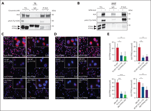 NPM-ALK interacts with PTPN1 and PTPN2. (A) Co-IP assay was performed on TS cells treated with 300 nM crizotinib for 3 hours. Co-IP was performed with anti-ALK antibody (IP ALK) or the corresponding isotype control (IgG) and analyzed by western blot probed with the indicated antibodies. One representative experiment out of 2 is shown. (B) Co-IP was performed on 293T cells transfected with NPM-ALK or the mock vector (-) and collected after 48 hours. Co-IP was performed with anti-ALK antibody (IP ALK) or the corresponding isotype control (IgG) and analyzed by western blot probed with the indicated antibodies. One representative experiment out of 2 is shown. (C-D) Representative images of in situ PLA (red) between NPM-ALK and PTPN1 (C) and NPM-ALK and PTPN2 (D) in TS and JB6 cell lines. WT TS and JB6 cells treated for 12 hours with TL13-112 100 nM were used as control to specifically reduced the anti-ALK antibody binding; PTPN1 KO and PTPN2 KO JB6 and TS cells were used as negative controls to remove anti-PTPN1 and PTPN2 antibody binding. (E) Quantification of PLA between ALK and PTPN1 and ALK and PTPN2 (C). Data are represented as mean ± SD; *P < .05, Student t test. TCL, total cell lysates.