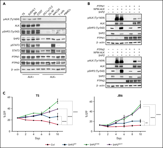 SHP2 phosphorylation is increased in ALK+ ALCL. (A) Western blot analysis performed on human ALK+ ALCL (TS, SU-DHL-1, JB6, and COST), ALK- ALCL (OCI-Ly13.2, DL-40, and MAC2A) and healthy donor T cells and PBMCs with the indicated antibodies. (B) Western blot analysis performed on 293T cells transduced with a doxycycline-inducible lentivirus expressing PTPN1 or PTPN2. 293T-HEK cells were transfected with NPM-ALK and/or SHP2 vectors as indicated, induced with doxycycline for 48 hours, and then collected. Cell lysates were blotted with indicated antibodies. β-Actin was used as a loading control. (C) Competitive cell growth assay performed on TS and JB6 cells transduced with a retrovirus expressing empty vector, SHP2wt, and SHP2E76K or SHP2D61Y mutant vectors cultured in presence of 40 nM crizotinib for indicated time. Data are represented as means ± SD of technical triplicates; **P = .0061 ****P < .0001, 2-way ANOVA followed by Dunnett's multiple comparisons test.