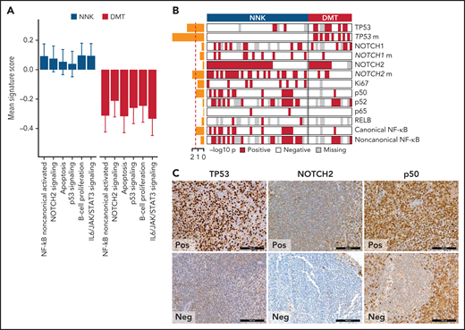 Biological attributes of the molecular clusters. (A) Barplot showing differential gene expression signature enrichment between NNK and DMT cluster. Statistical significance was determined using pairwise Student t tests on scaled activity score values and was <0.05 for all the gene sets (NF-κB noncanonical activated, P = .004; NOTCH2 signaling, P = .043; apoptosis, P = .009; p53 signaling, P = .028; B-cell proliferation, P = .014; IL6/JAK/STAT3 signaling, P = .003). (B) The heatmap shows the distribution of TMA markers in NNK and DMT molecular clusters. A red color indicates the positivity of the marker, a white color indicates the negativity of the marker, and gray color indicates missing data. The barplot on the left shows the -log10P value of a 1-sided Fisher’s exact test between the 2 clusters for each marker. (C) TP53, NOTCH2, and p50 expression in TMA cores from SMZL spleen sections.