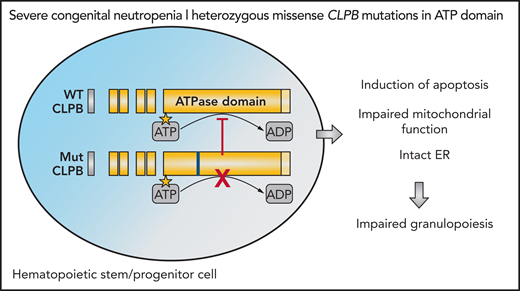CLPB variants in genetically unresolved SCN. Heterozygous missense ATP-binding pocket variants in CLPB act in a dominant-negative manner and disrupt wild-type (WT) CLPB function. Expression of CLPB variant is associated with mitochondrial dysfunction, increased apoptosis, and impaired granulocytic differentiation in HSPCs. ADP, adenosine 5′-diphosphate; ATPase, adenosine triphosphatase; Mut, mutant.