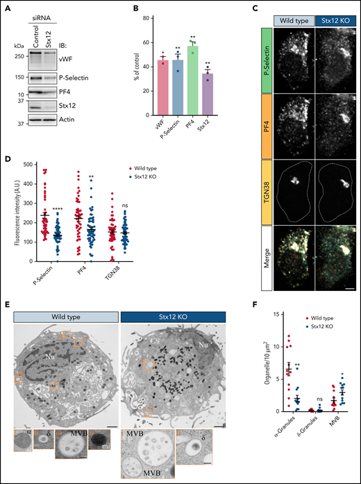Stx12 is required for normal α-granule biogenesis. (A) IB analysis of total extracts from imMKCL cells treated with either Control or Stx12 siRNA. (B) Quantification of the experiment is shown in A (n = 3). Stx12 siRNA samples were compared with Control siRNA, and statistical significance was determined via unpaired, 2-tailed Student t test. (C) Immunofluorescence microscopy analysis of wild-type (WT) or Stx12 KO imMKCL cells costained with antibodies against P-selectin, PF4, and TGN38. Bar = 5 µm. (D) Fluorescence intensity quantification of the experiment shown in C (WT, n = 50; Stx12 KO, n = 59). Stx12 KO samples were compared with WT samples, and statistical significance was determined via unpaired, Mann-Whitney U test. A.U., arbitrary units. (E) Thin-section transmission electron microscopy analysis of WT and Stx12 KO imMKCL cells subjected to high-pressure freezing. Original magnification, ×11 000 for the picture showing the entire cell and ×49 000 for the enlarged insets (bars represent 1 μm and 100 nm, respectively). (F) Quantification of α-granules, δ-granules, and MVBs visualized in the experiment shown in E (n = 12 cells per genotype). Stx12 KO samples were compared with WT samples, and statistical significance was determined via unpaired, Mann-Whitney U test. ν, nucleus; α, α-granules; δ, δ-granules; MVB, multivesicular body; mi, mitochondria.