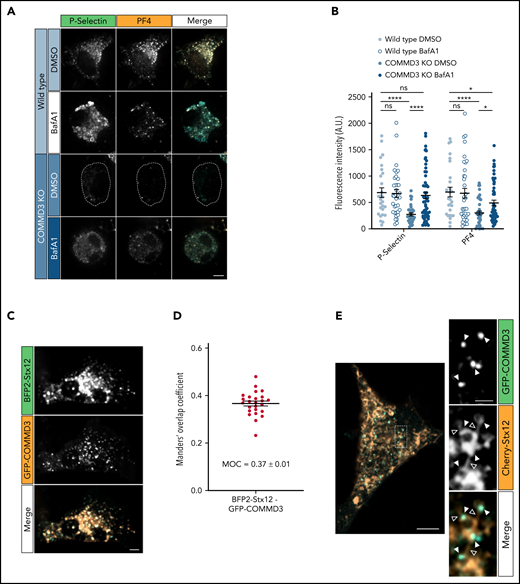 COMMD3 deficiency results in α-granule protein following a degradative pathway, and the COMMD3 protein localizes to Stx12-positive endosomal subdomains. (A) Immunofluorescence microscopy analysis of WT and COMMD3 KO imMKCL cells treated with either vehicle (DMSO) or BafA1 and costained with P-selectin and PF4 antibodies. Bar = 5 µm. (B) Fluorescence intensity quantification of the cells shown in (A). Statistical significance was determined via unpaired, Mann-Whitney U test (WT DMSO, n = 27; WT BafA1, n = 35; COMMD3 KO DMSO, n = 38; COMMD3 KO BafA1, n = 57). A.U., arbitrary units. (C) Spinning disk confocal microscopy analysis of a COMMD3 KO imMKCL cell expressing GFP-COMMD3 and BFP-Stx12. Bar = 5 µm. (D) Quantification of BFP-Stx12 and GFP-COMMD3 colocalization of the cells shown in C (n = 25). (E) Left, superresolution scanning confocal Airyscan image of a COMMD3 KO imMKCL cell expressing GFP-COMMD3 and Cherry-Stx12 (bar = 5 µm). Right, multichannel view magnification of the region indicated by the dashed line rectangle (bar = 1 µm). The filled triangles indicate endosomal subdomains where GFP-COMMD3 and Cherry-Stx12 colocalize, while open triangles point toward Cherry-Stx12 endosomal tubules, which are COMMD3-negative but are continuous with GFP-COMMD3-positive subdomains. Supplemental Figure 16 shows additional examples of superresolution scanning confocal Airyscan images of COMMD3 KO imMKCL cells expressing GFP-COMMD3 and Cherry-Stx12.