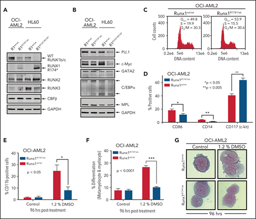 RUNX1R174* mutation in OCI-AML2 cells alters expression of CD86, CD14, and CD117 (c-Kit) and reduces DMSO-induced morphologic differentiation. (A-B) Representative immunoblot analysis of OCI-AML2, OCI-AML2 RUNX1R174*/wt, HL-60, and HL-60 RUNX1R174*/R174*. The expression levels of glyceraldehyde-3-phosphate dehydrogenase (GAPDH) in the cell lysates served as the loading control. (C) Cell cycle status of OCI-AML2 and OCI-AML2 RUNX1R174*/wt cells as determined by flow cytometry. Mean of 3 independent experiments. (D) Expression of CD86, CD14, and CD117 (c-Kit) in OCI-AML2 and OCI-AML2 RUNX1R174*/wt cells as determined by flow cytometry. Columns; mean of 3 experiments + standard error of the mean (SEM). * = expression values significantly different (*P < .05; **P < .005, by 2-tailed, unpaired t-test) in OCI-AML2 RUNX1R174*/wt compared with OCI-AML2 control cells. (E-G) Percent CD11b-positive and percent differentiated (metamyelocytes and myelocytes) OCI-AML2 and OCI-AML2 RUNX1R174*/wt cells following 96 hours treatment with 1.2% DMSO. In panels E and F, columns; mean of 3 experiments + (SEM). * = values significantly less (*P < .05; ***P < .0001, by 2-tailed, unpaired t-test) in OCI-AML2 RUNX1R174*/wt compared with OCI-AML2 cells. Representative cells shown in panel G.