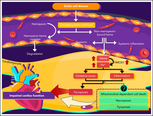 Mechanism of HMOX1-associated cardiac ferroptosis in a murine model of SCD. Intravascular hemolysis in SCD causes an increase in circulating heme. Excess non–hemopexin-bound heme enters cardiomyocytes, and HMOX1 is upregulated, resulting in cardiomyocyte Fe2+ overload. These events lead to cardiomyocyte ferroptosis, which is responsible for impaired cardiac function. Although both oxidative stress and inflammation due to cardiac iron overload have been shown to cause different types of regulated cell death in cardiomyocytes, detailed knowledge concerning the type of cell death would facilitate vital care, with the potential of improved treatment of SCD.