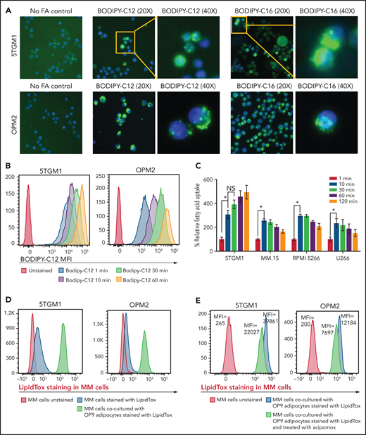 FAs secreted from adipocytes are directly taken up by myeloma cells. (A) Representative images stained by using BODIPY fluorophore-labeled 12-carbon long-chain FA and 16-carbon long-chain FA in murine 5TGM1 and human-derived OPM2 myeloma cells. (B) Flow cytometric analysis of BODIPY C12 FA uptake by 5TGM1 and OPM2 MM cells preincubated with the fluorescent dodecanoic acid FA measured at 1, 10, 30, and 60 minutes. (C) Measurement of FA uptake at 1, 10, 30, 60, and 120 minutes in MM cells using the MAK156 kit (MilliporeSigma). The kit uses a fluorescent dodecanoic FA substrate whose uptake into cells results in an increase in fluorescent intensity measured at λex = 485/λem = 515 nM. (D) Fluorescent intensity profiles of LipidTOX Deep Red–labeled lipids transferred from adipocytes to MM cells (5TGM1 and OPM2) either cultured alone or cocultured with OP9 adipocytes. (E) Reduction of labeled BODIPY C12 uptake by 5TGM1 and OPM2 MM cells through inhibition of adipocyte lipolysis by acipimox treatment. Data are presented as mean ± standard error of the mean. *P < .05.