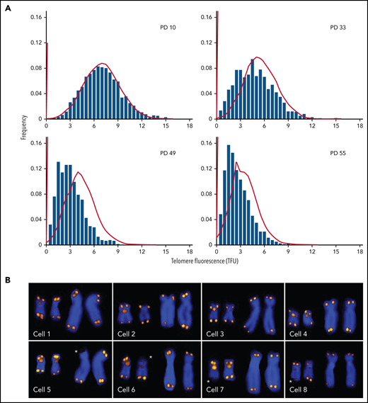 Q-FISH measurements of metaphase chromosomes from human fibroblasts at different population doublings (PDs). The telomere length values are increasingly skewed toward short telomeres as the cultured cells approach senescence. (A) Actual data (bars; adapted from Martens et al, with permission28) correspond to predictions based on a mathematical model (lines; adapted from Rodriguez-Brenes and Peskin with permission99) but show more pronounced skewing. (B) Snapshots of Q-FISH images of chromosomes X and 17 (also hybridized with a Chr17-specific probe) from individual metaphase cells of different diploid fibroblasts clones. For details see Martens et al,28 Asterisks indicate sporadic loss of telomere repeats on specific chromosome arms. Q-FISH, quantitative fluorescence in situ hybridization.