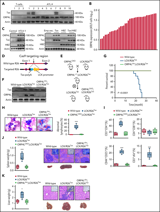 ORP4L knockout prevents HTLV-1 oncogene Tax-induced T-cell leukemia in mice. (A) Western blot analysis of Tax and ORP4L expression in normal human T cells and T cells of patients with ATL. (B) Quantitative PCR (qPCR) analysis of ORP4L expression in normal human T cells (n = 5) and human ATL T cells (n = 37). (C) Western blot analysis of ORP4L expression in HTLV-1–infected human T cells (left) and human T cells infected with a lentivirus carrying Tax, HBZ, or both. T cells were infected with HTLV-1 or transduced with lentivirus and cultured in vitro for 16 weeks. (D) The targeting construction used to generate the T-cell–expressing Tax knockin mice. (E) Schematic representation of mouse line crossing strategy. (F) Western blot analysis of the expression of ORP4L in T-cells from 2-month-old WT, LCK/R26Tax, and ORP4Lcko;LCK/R26Tax mice. (G) Kaplan-Meier comparative survival analysis of WT, LCK/R26Tax, and ORP4Lcko;LCK/R26Tax mice (n = 12 mice of each group, log-rank test). (H) Representative images of peripheral blood smears from sick LCK/R26Tax mice and WT or ORP4Lcko;LCK/R26Tax littermate mice. Morphologically abnormal leukemic cells with large nuclei were present. The number of abnormal lymphocytes on the smears from each cohort are shown. Scale bars, 100 μm. (I) The percentage of CD3+CD4+, CD4+CD8+, CD44+CD25+, and CD3+c-kit+ cells in the peripheral blood of sick LCK/R26Tax mice and WT or ORP4Lcko;LCK/R26Tax littermate mice. Mean ± standard deviation (SD; n = 7 mice of each group; Student t test). (J-K) Splenomegaly (J) and hepatomegaly (K) in sick LCK/R26Tax mice and WT or ORP4Lcko;LCK/R26Tax littermate mice. Representative histologic hematoxylin and hematoxylin eosin–stained sections show T-cell infiltration and immunohistochemical images with positive CD3-specific antibody staining. Scale bars, 100 μm. Mean ± SD (n = 7 mice of each group; Student t test). *P < .05; ***P < .001.