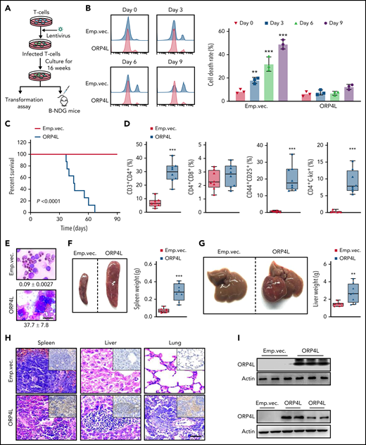 ORP4L expression induces T-cell malignant transformation and T-cell leukemogenesis in mice. (A) The experimental design. Normal murine CD4+ T cells were infected with lentivirus with or without ORP4L expression and cultured for 16 weeks in vitro; then, the cells were used for malignant transformation assay or B-NDG mice transplantation. (B) Cell death analysis of T cells infected with lentivirus carrying ORP4L or not. After culture for 16 weeks in vitro, the cell death rates were detected at 0, 3, 6, and 9 days after removing the IL-2 from the culture medium. Mean ± standard deviation (SD; n = 3 experiments; Student t test). (C) Kaplan-Meier comparative survival analysis of B-NDG mouse recipients of T-cell transplants with or without ORP4L expression (n = 8 mice each group, log-rank test). (D) The percentage of CD3+CD4+, CD4+CD8+, CD44+CD25+, and CD3+c-Kit+ cells in the peripheral blood of B-NDG mice treated as in panel C (n = 8 mice each group; Student t test). (E) Representative images of peripheral blood smear from B-NDG mice treated as in panel C. The number of abnormal lymphocytes is indicated below the smears for both cohorts. Bar represents 10 μm. (F-G) Splenomegaly (F) and hepatomegaly (G) in B-NDG mice treated as in panel C. Representative organs are shown on the left, with organ weights on the right. Mean ± SD (n = 8 mice each group; Student t test). (H) Representative histologic hematoxylin and eosin–stained sections showing T-cell infiltration in spleen, liver, and lung of B-NDG mice treated as in panel C. Immunohistochemical human CD3-specific antibody staining (insets) of the tissues are shown. Bar represents 100 μm. (I) Western blot analysis of ORP4L expression in T cells. ORP4L expression in T cells infected with lentivirus with or without ORP4L before transplantation (top) or ORP4L expression in T cells isolated from 2 B-NDG mice after transplantation when the mice are sick (bottom). **P < .01; ***P < .001.