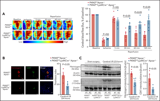 Myeloid cell–specific PKM2−/− mice exhibited improved local cerebral blood flow and reduced poststroke cerebral thrombosis. (A) Left: representative images were taken by using laser speckle imaging of regional cerebral blood flow in the cortical region. Right: quantification at different time points (5 to 120 minutes). (B) Left: representative immunostaining images for platelets (CD41+, green; fibrinogen, red). Scale bar, 100 μm. Right: thrombotic index as defined by the ratio of occluded brain vessels to the total brain vessels in the ipsilateral hemisphere. (C) Brain homogenates from the infarcted and peri-infarcted area after 1 hour of ischemia and 23 hours of reperfusion were processed for western blotting: representative western blots and densitometric analysis of fibrinogen and platelets (CD4+). β-actin was used as a loading control. All data are from male mice and are mean ± SEM; n = 5 (A); n = 4 (B-C). Data are from 2-way repeated measures ANOVA (Kruskal-Wallis test) followed by Fisher’s LSD test (A), or an unpaired Student t test (B-C). I/R, ischemia and reperfusion.