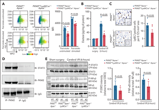 PKM2 mediates poststroke inflammation by promoting phosphorylation of STAT3 in neutrophils. (A) Left: representative image of flow cytometric analysis for MPO from each group. Right: quantification of MPO expression levels in peripheral neutrophils isolated 6 hours post-reperfusion in mice with stroke. Neutrophils were stimulated with a suboptimal concentration of PMA (10 ng/mL). (B) Elastase levels as determined by ELISA from the cell extracts of peripheral neutrophils, isolated 6 hours post-reperfusion in mice with sham-surgery or stroke. (C) Left: representative immunostained images for neutrophils (brown Ly6B.2-positive cells indicated by red arrows) in infarcted brain regions. Inset in the boxed region is magnified and shown in microphotograph. Scale bar, 100 μm. Right: quantification. (D) Peripheral neutrophils were isolated 6 hours postreperfusion in mice with stroke, and cell extracts were IP with PKM2 antibody or control IgG and immunoblotted for PKM2 and STAT3. (E) Western blot analysis of PKM2 cell extracts from the peripheral neutrophils isolated 6 hours post-reperfusion in mice with stroke. The quantitative phospho STAT3 and phospho NF-κβ intensity (normalized to the total STAT3 and NF-κβ, respectively) are shown on the right. Data are from female mice and are mean ± SEM. n = 5 (A); n = 3-4 (B-C,E). Data are from 2-way repeated measures ANOVA (Kruskal-Wallis test) followed by Fisher’s LSD test (A-B) and unpaired Student t-tests (C,E). FSC, forward scatter; IgG, immunoglobulin G; IP, immunoprecipitated; MPO, myeloperoxidase; MFI, mean fluorescence intensity.