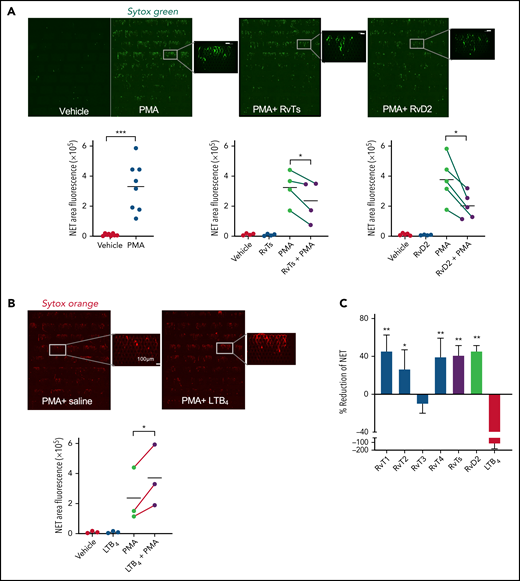 RvTs reduce NETs in human peripheral blood. Human blood (500 μL) was incubated with RvT1, RvT2, RvT3, and RvT4 (10 nM each) individually, or with a combination of RvTs (RvT1-RvT4; 2.5 nM each), RvD2 (10 nM), LTB4 (10 nM), or vehicle control (0.01% ethanol v/v in saline) at 37°C for 15 minutes followed by the addition of PMA (1 μg/mL) for 4 hours. Aliquots of blood (50 μL) were added to Sytox Green (450 μL) and loaded onto the inlet reservoirs of the microfluidic NET devices. NETs captured within the micropost arrays were then imaged and quantified. (A) (Top panels) Representative images of fluorescent NETs using Sytox Green. Scale bars = 100 μm. (Bottom panels) Results are expressed as NET areas. The NET areas of PMA and PMA plus RvTs or RvD2 obtained from the same donors are connected by green lines. n = 4 (RvTs) or n = 5 (RvDs) separate donors. *P < .05, ***P < .001, paired two-tailed Student t test. (B) (Top panels) Representative images of fluorescent NETs using Sytox Orange. Scale bars = 100 μm. (Bottom panel) The NET areas of PMA and PMA plus LTB4 obtained from the same donors are connected by red lines. n = 3 separate donors. *P < .05, paired two-tailed Student t test. Details on imaging and quantification are given in the "Materials and methods." (C) Results are percent reduction of NETs compared with PMA alone. Mean ± SEM. n = 3 to 5. *P < .05, **P < .01, vs LTB4.