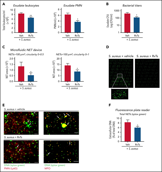 RvTs limit S aureus infection and reduce NETs in vivo. Mice were given a panel of RvTs (RvT1, RvT2, RvT3, and RvT4; 50 ng each) or vehicle control together with live S aureus (107 CFU) by intra-pouch injection. Sixteen hours later, pouch exudates were collected. (A) Exudate leukocytes were enumerated by using light microscopy and PMN percentages determined by differential counting. Mean ± SEM. n = 7 (leukocytes) or n = 4 (PMNs). *P < .05, **P < .01, two-tailed Student t test. (B) Exudate bacterial titers were determined by enumerating colonies on LB agar plates. Mean ± SEM. n = 6. *P < .05, two-tailed Student t test. (C) NETs were quantified by using the microfluidic NET devices. Exudate cells (2 × 105 cells) were incubated with Sytox Green (5 µM) for 15 minutes and loaded onto the microfluidic NET device. NETs were quantified according to 2 criteria: (left) long-string NETs > 100 μm2 (fluorescent areas larger than 100 μm2 in size with a shape circularity 0-0.5) or (right) NETs > 100 μm2 (fluorescent areas larger than 100 μm2 in size with shape circularity 0-1). Mean ± SEM. n = 5 or 6. *P < .05, two-tailed Student t test. (D) Representative images of NETs > 100 μm2 and shape circularity 0-1. (E) Representative images. Exudate cells (2 × 105 cells) were adhered onto 8-well chamber slides, incubated with Sytox Green (5 µM), followed by staining with (left panels) phycoerythrin-conjugated anti-Ly6G antibody for mouse PMN or (right panels) goat anti-mouse MPO antibody. Arrows denote NETs. Scale bars = 50 μm. (F) NETs were quantified by using a fluorescence plate reader. Exudate cells (1 × 105 cells) were adhered onto a 96-well plate, incubated with Sytox Green (5 µM) for 20 minutes, and fluorescence determined. Mean ± SEM. n = 7. *P < .05, two-tailed Student t test. Veh, vehicle control.
