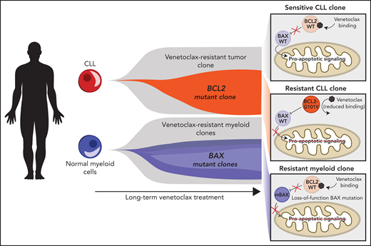 Schematic representation of clonal expansions in CLL and normal myeloid cells. On long-term venetoclax treatment, CLL cells undergo clonal selection resulting in expansion of the resistant clones harboring mutations in the BCL2 gene, for example, BCL2-G101V. Concomitantly, in the normal myeloid compartment, venetoclax results in clonal selection of BAX loss-of-function mutations (mBAX). Thus, venetoclax results in lineage-specific clonal expansions harboring alternative resistance mechanisms.