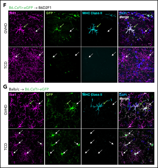 Differential expression of MHC class II by donor-derived macrophages and host microglia late after transplant. (A) Schematic of transplantation regime for the identification of donor macrophages and host microglia. Lethally irradiated DBA2xF1.Csf1r-eGFP (H2b/d) mice received 5 × 106 TCD BM with no T cells or with 0.5 × 106 CD3+ T cells from C57Bl/6.Csf1r-mApple (H2b) donors to induce low-grade nonlethal cGVHD. (B) Representative flow cytometric dot plots for the identification of donor macrophages (mApple) and host microglia (MacGreen) within the CD45dimCD11b+ population from digested coronal sections of the brains of cGVHD mice at days 14, 35, and 70 after transplant. Gated on forward and side scatter to identify live (Sytox Blue−) CD45+Ly6G− cells. (C) Proportions of host microglia and donor BMDMs within the CD45dimCD11b+ population in cGVHD brains (day 14: n = 3; day 35: n = 7; data pooled from 2 independent experiments; day 70: n = 13; data pooled from 4 independent experiments). (D) Representative histograms of MHC class II expression on TCD microglia compared with GVHD host microglia and donor BMDMs at days 35 and 70 after transplant. (E) Fold change of MHC class II mean fluorescence intensity (MFI) on GVHD host microglia and donor BMDMs relative to TCD host microglia at days 35 and 70 posttransplantation (day 35: n = 7; data pooled from 2 independent experiments; day 70: n = 9; data pooled from 2 independent experiments). (F) Representative ×100 original magnification confocal images demonstrating differential expression of MHC class II by donor macrophages (green arrows) and host microglia (white arrows) in situ in the hippocampus of GVHD and TCD mice 70 days after transplant. B6.Csf1r-eGFP donors used to facilitate identification of donor-derived macrophages (GFP+/Iba1+) compared with resident microglia (GFP−/Iba1+). Nuclei counterstained with 4′,6-diamidino-2-phenylindole (DAPI). Original magnification ×100; scale bar, 10 μm. (G) Findings replicated in a second model of cGVHD (day 70 after transplant) where BALB/c donor BM plus CD3+ T cells were transplanted into B6.Csf1r-eGFP recipients. MHC class II expression restricted to donor Iba1+/GFP− BMDMs (green arrows) and absent from host Iba1+/GFP+ microglia (white arrows). Original magnification ×100; scale bar, 10 μm. Data presented as mean ± standard error of the mean. Statistical significance calculated by 1-way analysis of variance with multiple comparisons (C) or unpaired Student t test (E). **P < .01, ***P < .001.