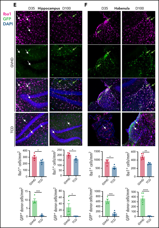 CNS cGVHD is associated with resident microglia proliferation and activation and donor-derived macrophage infiltration. (A) Allogeneic transplantation model for the delivery of 5 × 106 TCD BM from C57Bl/6 (H2b) donors expressing eGFP under the Csf1r promoter (B6.Csf1r-eGFP) with no T cells or with 0.5 × 106 CD3+ T cells into lethally irradiated B6D2F1 (H2b/d) recipients. (B-F) Representative confocal images of parenchymal brain regions of interest in GVHD and TCD mice, showing Iba1+ microglia/macrophages, GFP+ donor BMDMs, and merged images counterstained with 4’,6-diamidino-2-phenylindole (DAPI; cell nuclei). Green arrows identify donor-derived (GFP+) macrophages, and white arrows indicate resident (GFP−) microglia. Stereological quantification of each region shows the total Iba1+ cell population alongside the number of GFP+ donor BMDMs. (B) Meninges at days 35 and 100 after transplant. Original magnification ×40; scale bar, 30 μm. (C) Choroid plexus at days 35 and 100 posttransplantation. Original magnification ×40; scale bar, 30 μm. Dashed lines outline choroid plexus in the lateral ventricle adjacent to surrounding tissue. (D) Cortex at days 35 and 100 after transplant. Original magnification ×20; scale bar, 50 μm. (E) Hippocampal dentate gyrus at days 35 and 100 after transplant. Original magnification ×20; scale bar, 50 μm. (F) Habenula at days 35 and 100 after transplant. Original magnification ×40; scale bar, 30 μm. Data presented as mean ± standard error of the mean (n = 4-5 mice per group). Statistical differences calculated with unpaired Student t test. *P < .05, **P < .01, ***P < .001, ****P < .0001.