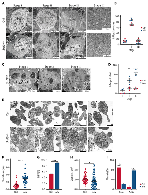 SRSF3 depletion leads to MK maturation arrest and macrothrombocytopenia. (A) Representative TEM images depicting the ultrastructure of control and Pf4-Srsf3Δ/Δ MKs at stage I, II, and III of maturation. Scale bars represent 5, 10, and 10 µm, respectively. On the right, a higher magnification of the boxed areas in stage III MKs. Scale bars represent µm. (B) Quantification of control and Pf4-Srsf3Δ/Δ MKs at each stage of maturation. (C) Representative TEM images of Pf4-Srsf3Δ/Δ MKs at stage I, II, and III of maturation displaying emperipolesis. Scale bars represent 5, 10, and 10 µm, respectively. (D) Quantification of the fraction of Pf4-Srsf3Δ/Δ MKs at each maturation stage displaying emperipolesis. (E) Representative TEM images of control and Pf4-Srsf3Δ/Δ platelets. Scale bars are 1 μm. (F) Quantification of control and Pf4-Srsf3Δ/Δ platelet area. (G) Mean platelet volume of control and Pf4-Srsf3Δ/Δ platelets. (H) Quantification of the number of granules in control and Pf4-Srsf3Δ/Δ platelets. (I) Quantification of the fraction of resting and activated control and Pf4-Srsf3Δ/Δ platelets. Platelets with filopodia, rounded shape, and/or centralised granules were classified as activated. The data are presented as mean plus or minus SEM. Two-way ANOVA in panels B and D and 2-tailed unpaired Student t test in panels F through I. ****P ≤ .0001; ***P ≤ .001; **P ≤ .01; *P ≤ .05. Activ, activated; rest, resting.
