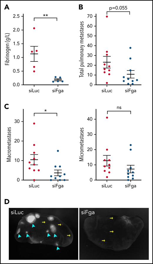 siFga decreases the formation of pulmonary macrometastases in a model of experimental metastasis. Mice were injected with siLuc (red) or siFga (blue) weekly for 3 weeks prior to intravenous inoculation with GFP-expressing LLC cells (LLCGFP), and blood and tissue were collected 14 days later. (A) Plasma fibrinogen concentrations were quantified by ELISA (n = 5). (B) Total pulmonary LLCGFP metastases in mice treated with control siLuc or siFga (n = 10). (C) Total number of pulmonary LLCGFP macrometastases (left) and micrometastses (right). (D) Representative images of lung lobes from siLuc- (left) and siFga- (right) treated mice. The cyan arrowheads indicate macrometastases, and the yellow arrows indicate micrometastases. *P < .05, **P < .01. ns, no significant difference. Error bars represent mean ± SEM.