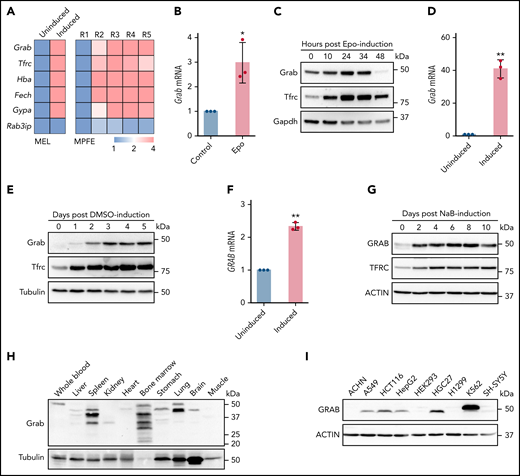 Grab is upregulated in differentiating erythroblasts. (A) Relative expression of Grab and control genes from RNA sequencing analyses on differentiating MEL cells (left)22 and mouse primary fetal liver erythroblasts (MPFE, right).25 MEL cells before (uninduced) and after DMSO-induced differentiation were analyzed. R1 to R5 represent the progressive stages of differentiating erythroblasts. (B-C) qRT-PCR (B) and immunoblotting (C) analyses of Grab in differentiating mouse fetal liver erythroblasts. Erythropoietin (Epo) was supplemented to the erythroid progenitors isolated from the livers of E14.5 mouse embryos to induce the erythroid differentiation. Tfrc and Gapdh were used as controls. *P < .05. (D-E) qRT-PCR (D) and immunoblotting (E) analyses of Grab in MEL cells before and after DMSO-induced erythroid-like differentiation. Tfrc and Tubulin were used as controls. **P < .01. (F-G) qRT-PCR (F) and immunoblotting (G) analyses of GRAB in K562 cells before and after sodium butyrate (NaB)-induced erythroid-like differentiation. TFRC and ACTIN were used as controls. **P < .01. (H-I) Western analyses of Grab in multiple mouse tissues (H) and human cell lines (I).
