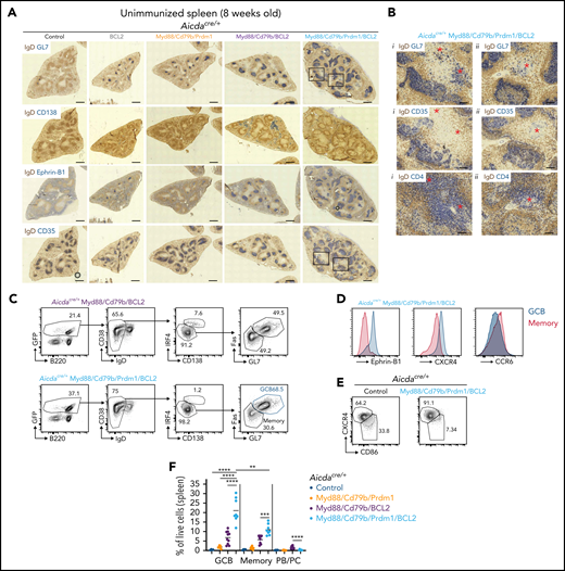 Overexpression of BCL2 cooperates with Myd88/Cd79b/Prdm1 to induce massive expansion of aberrant spontaneous splenic GCBs. (A) Immunohistochemistry of unimmunized spleens from 8-week-old mice that were Aicdacre/+ and control, Rosa26LSLBCL2-IRES-GFP (BCL2), Myd88/Cd79b/Prdm1, Myd88/Cd79b/BCL2, or Myd88/Cd79b/Prm1/BCL2. Sections were stained for IgD and GL7, CD138, Ephrin-B1, or CD35. Scale bar = 500 μm. Additional examples of Aicdacre/+ Myd88/Cd79b/BCL2 or Aicdacre/+ Myd88/Cd79b/Prdm1/BCL2 mice are shown in supplemental Figure 3A. (B) High-power images of areas marked in panel A. Sections were stained for IgD and GL7, CD35, or CD4. Red asterisks mark areas of GL7+ cell infiltration into T-cell areas of spleens of Myd88/Cd79b/Prdm1/BCL2 animals. Scale bar = 100 μm. (C) Flow cytometry of splenocytes from Aicdacre/+ Myd88/Cd79b/BCL2 or Aicdacre/+ Myd88/Cd79b/Prdm1/BCL2 mice. (D) Expression of Ephrin-B1, CXCR4, or CCR6 on splenic GCs or MBCs from Aicdacre/+ Myd88/Cd79b/Prdm1/BCL2 mice. (E) Expression of LZ or DZ GC markers on splenic GCBs from Aicdacre/+ control or Myd88/Cd79b/Prdm1/BCL2 mice. (F) Frequency of splenic GCBs, MBCs, or PBs/PCs in 8- to 10-week-old Aicdacre/+ control, Myd88/Cd79b/Prdm1, Myd88/Cd79b/BCL2, or Myd88/Cd79b/Prdm1/BCL2. Data in panels A and B are representative of 2 to 5 mice per genotype; data in panels C to E are from one experiment representative of 4 independent experiments with 1 mouse per group; and data in panel F are pooled from 8 independent experiments with up to 1 mouse per group per experiment. **P < .01, ***P < .001, ****P < .0001, unpaired two-tailed t test.
