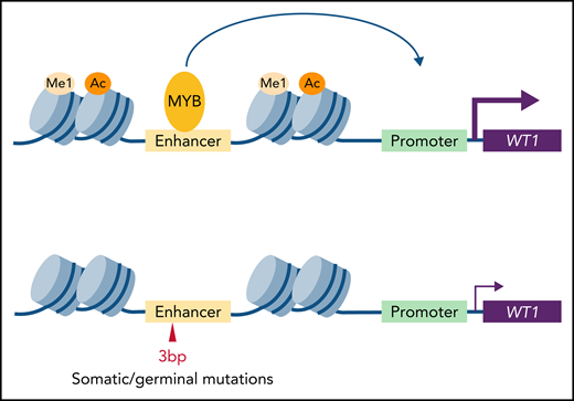 In APL patients, focal somatic mutations or germinal SNP in cis-regulatory regions disrupt MYB binding, reduce H3K27ac/H3K4me chromatin signatures of active enhancers, and disrupt interaction with the proximal promoter, all yielding WT1 repression.