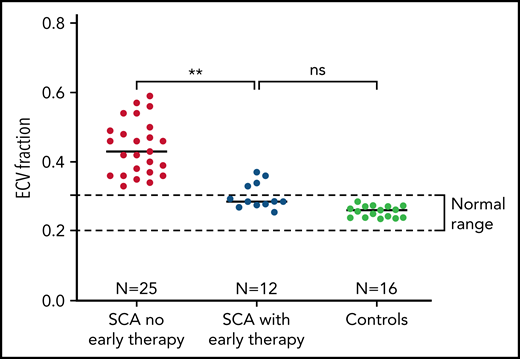 Prevention of diffuse myocardial fibrosis in SCA with early initiation of disease-modifying therapy. Patients who had early initiation and uninterrupted use of hydroxyurea or chronic transfusions had significantly less myocardial fibrosis than patients with no early therapy. Mean ECV was 0.30, which was significantly lower than the ECV of individuals with SCA who have not received early uninterrupted therapy (0.44, P = .002) and not different from normal controls (0.26 ± 0.02; P = .11).