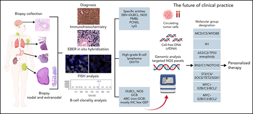 Algorithm for the diagnostic workup of aggressive B-cell lymphomas. The current algorithm for diagnosing aggressive large B-cell lymphomas starts with a biopsy collection from a lymph node (excision or needle biopsy) or a biopsy of an extranodal site. The diagnosis of the different lymphoma entities is based on a combination of morphology, immunophenotype, EBER in situ hybridization, FISH analysis, and B-cell clonality analysis. Advances in the understanding of DLBCL herald a transition to a molecular genetic classification (red arrow). This genetic classification is based on mutational profile, somatic copy number alterations, and structural variants. The depicted molecular subtypes were identified in 3 different studies indicating that these subgroups reflect true biological differences.131,132,134 On the basis of these molecular studies, a predictor model was developed that dissects the cell-of-origin and stratifies further the molecular classification into 7 genetic subtypes with apparently clinical relevance.133 The acronyms indicate the names given in the different studies to the same identified biological group.