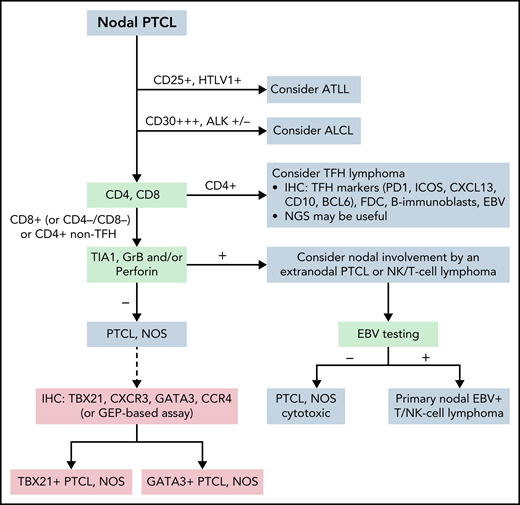 Algorithm for the classification workup of nodal PTCLs. The current algorithm for diagnosing PTCL requires immunophenotypic study with a panel of markers that, together with viral analysis (HTLV1, EBV), will orient the pathologist to consider and diagnose specific entities. In ambiguous cases, sequencing studies may help diagnose some entities, particularly follicular helper T-cell lymphoma. PTCL, NOS is established when other specific entities are excluded. Phenotypic analysis or analysis by GEP may subdivide patients with PTCL, NOS, but this subclassification is not routinely incorporated into clinical diagnosis and requires further studies for clinical validation. ATLL, adult T-cell leukemia/lymphoma; GrB, granzyme B; Per, perforine.