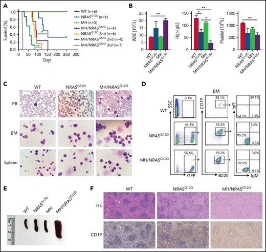 MH-fusion drove BCP-ALL in combination with NRASG12D mutation. (A) Kaplan-Meier survival analysis of WT, NRASG12D, MH, and MH/NRASG12D mice. The sample size (n) used in this study is indicated. (B) The WBC, hemoglobin (Hgb), and platelet levels of the MH/NRASG12D mice who died were compared with the WT, NRASG12D, and MH mice at the same age. (C) Morphologic analysis with Wright’s staining of the cells in PB, BM, and spleen of WT, NRASG12D, and MH/NRASG12D mice. (D) FACS analysis of cells in the BM. (E) Spleen sizes from WT, NRASG12D, MH, and MH/NRASG12D mice. (F) Hematoxylin and eosin (HE)-stained sections of the spleen derived from WT, NRASG12D, and MH/NRASG12D mice. Data are presented as mean ± standard error of the mean and were analyzed by using the t test. *P < .05, **P < .01.