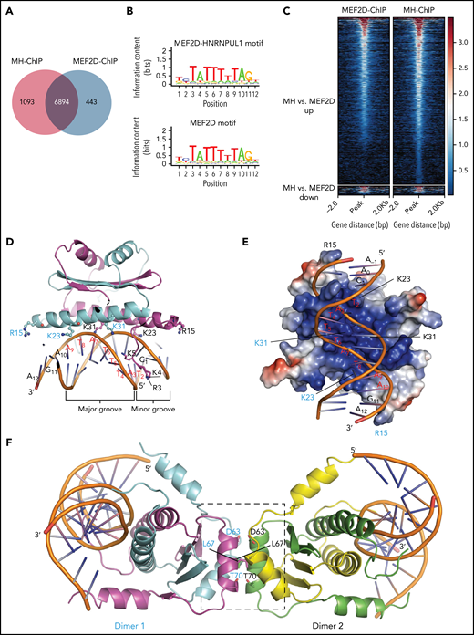 ChIP-seq analysis revealed MEF2D-MRE and crystallographic characterization of MEF2D-DNAMRE engagement. (A) Venn diagram illustrating the overlap between DNA regions bound by MH fusion or WT MEF2D, as identified by ChIP-seq analysis with anti-FLAG antibodies in CD34+ cells sorted from human cord blood. (B) MEF2D-MRE sequence. Motif analysis summarized the MEF2 DNA motifs found in the regions bound by MH or WT MEF2D. The ChIP-seq analysis with stable expression of MH fusion helped to uncover a consensus binding site in MH-driven transcriptional deregulation. (C) Density heatmap of MH and MEF2D binding peaks. Heatmap is shown for a region extending from −2 kb to 2 kb relative to the peak summit. Top, peaks with increased binding of MH compared with WT MEF2D. Bottom, peaks with decreased binding of MH compared with WT MEF2D. (D) Side view of the MEF2D2-95-DNAMRE complex. The crystal structure is shown in cartoon representation. The DNA-binding motifs R3/K4/K5 and R15/K23/K31 in the MEF2D are shown in ball and stick representations. The DNA nucleotides TATTTATA (ie, the MRE core) are labeled. The 2 subunits in MEF2D dimer are colored in magenta and cyan, respectively. (E) Vertical view of the MEF2D-DNA engagement. The protein is rendered according to the electrostatic charge in the surface, in which the positive and negative charges are shown in blue and red, respectively. (F) MEF2D tetramer and MRE crosslinking. Four MEF2D subunits are colored in magenta, cyan, yellow, and green, respectively. D63/L67/T70 in the tetrameric interface (boxed) are labeled and shown in stick representation.