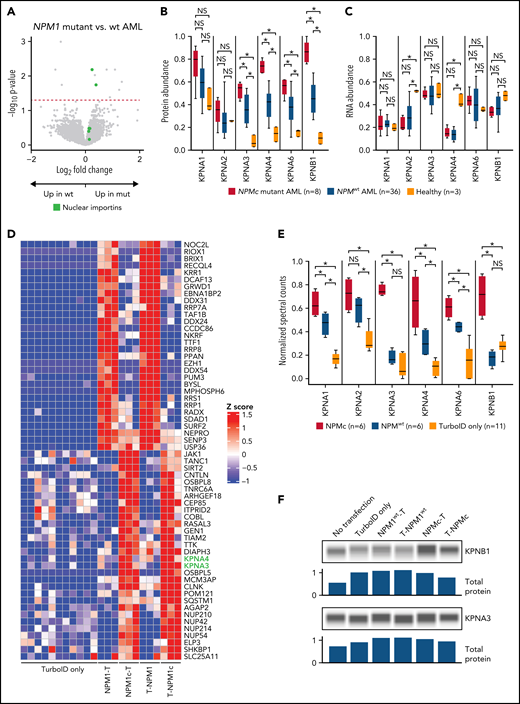 AML samples with the NPMc mutation are associated with increased abundance of several nuclear importins, and NPMc interacts directly with several family members. (A) Volcano plot showing protein abundance in NPM1-mutated vs wt AML samples. P values are calculated using the t test and corrected for multiple-hypothesis testing with Benjamini-Hochberg method. Dashed red line shows P = .05. (B-C) Normalized abundance of the nuclear importins organized by NPM1 mutation status in TMT data (B) and bulk RNA sequencing data (C). *P < .05 by t test between groups. (D) TurboID vectors were created with no fused complementary DNA (cDNA) (“TurboID only”) or fused at either the N or C terminus of wt NPM1 or mutant NPMc (T-NPM1 and T-NPMc indicate N-terminal fusions, whereas NPM1-T and NPMc-T indicate C-terminal fusions). Each vector was stably transduced into primary mouse hematopoietic stem/progenitor cells and, after 4 days, cultured in the presence of biotin for 4 hours. Biotin-labeled proteins were then enriched with streptavidin beads and stringently washed, and tryptic peptides were released from the beads and identified by mass spectrometry. Z-scores are calculated based on spectral counts across 10 TurboID-only biological replicates and 3 biological replicates for each of the other indicated vectors. The 30 interacting proteins with the greatest fold change for the NPM1-TurboID constructs are shown; all display significant differences (t test, multiple-hypothesis correction by Benjamini-Hochberg method with P < .05) from samples expressing TurboID only and NPMc-TurboID. Similarly, 30 proteins with the greatest fold change were selected for the NPMc-TurboID vector, and all displayed significant differences from both wt NPM1 and TurboID only. KPNA3 and KPNA4, 2 members of the nuclear importin family, are highlighted in green. (E) Spectral counts detected in the TurboID experiments for each of the displayed nuclear importins are normalized for display between 0 and 1. *P < .05 by t test between groups. N- and C-terminal TurboID constructs are analyzed together for the NPM1 and NPMc vectors. (F) Western blotting of protein abundance for the indicated proteins in cell lysates created from the stably transduced mouse bone marrow cells prior to streptavidin pulldown. Normalized total protein for each lane is shown as a loading control as determined on the Jess western blotting system. In this short-term expression system, the abundance of the nuclear importins is not increased, suggesting that the detection of interactions with NPMc is not due to an increase in total importin protein abundance. One representative example from 3 biologic replicates is shown. mut, mutant; NS, not significant.