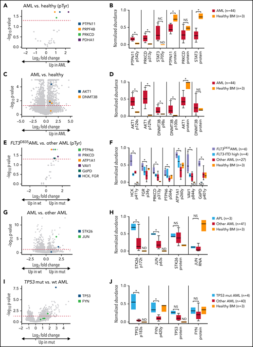 Phosphoproteomic analyses of AML samples associated with specific mutations. (A) Volcano plot showing phosphorylated tyrosine sites in AML samples vs lineage-depleted bone marrow from healthy donors. P values are calculated using the Mann-Whitney U test and corrected for multiple-hypothesis testing with Benjamini-Hochberg method. Dashed red line shows P = .05. (B) Normalized abundance of selected tyrosine phosphosites with differences between AML and healthy samples, including the activating site tyrosine-546 on the phosphatase PTPN11/SHP2, the activating site tyrosine-313 on PRKCD, and the activating site tyrosine-705 on STAT3. Total protein abundance for all 3 proteins is shown as well, indicating that increased phosphorylation of these sites is not due to changes in overall protein abundance in AML samples. *P < .05 represent significantly different sites after multiple hypothesis correction as calculated in panel A. All sites were normalized to between 0 and 1 for display. (C) Volcano plot showing all phosphorylated sites in AML samples vs lineage-depleted bone marrow from healthy donors. P values are calculated using the t test and corrected for multiple-hypothesis testing with Benjamini-Hochberg method. Dashed red line shows P = .05. (D) Normalized abundance of selected phosphosites with differences between AML and healthy samples, including the serine-124 in the linker domain involved in optimal activation of AKT1 and multiple sites on DNMT3B of unknown function. Total protein abundance of AKT1 and DNMT3B are shown as well. *P < .05 after multiple-hypothesis correction as in panel C. (E) Volcano plot showing tyrosine phosphorylation sites comparing between FLT3D835-mutant AML samples and FLT3 wt AML samples as determined by 1-sided Mann-Whitney U test with multiple-hypothesis correction by Benjamin-Hochberg method. (F) Normalized abundance for each of the indicated phosphosites in the indicated patient groups. *P < .05 represents significantly different tyrosine phosphorylation sites between FLT3D835-mutant AML samples and FLT3 wt AML samples as determined in panel E. ND indicates a phosphosite was not detected in that group. Only FLT3-ITD samples with high variant allele frequency are shown. (G) Volcano plot showing differentially phosphorylated sites in samples initiated by PML-RARA (APL) vs other AML. P values are calculated using the t test and corrected for multiple-hypothesis testing with Benjamini-Hochberg method. (H) Normalized abundance of phosphorylated threonine-172 in the activation loop site on the kinase STK26 in APL vs other AML and healthy bone marrow. Total STK26 protein abundance is also shown. Normalized abundance of phosphorylation of the known activating site serine-63 on the transcription factor JUN in APL vs other AML and healthy bone marrow. Normalized abundance of JUN RNA is shown, since total JUN protein was below the limits of detection in this dataset. (I) Volcano plot showing differentially phosphorylated sites in TP53-mutant vs wt AML. P values are calculated using the t test and corrected for multiple-hypothesis testing with Benjamini-Hochberg method. (J) Abundance of the degradation related site serine-183 on TP53 and the activating site tyrosine-420 on FYN. NC, not calculable due to site being not detected in healthy samples; BM, bone marrow; ND, not detected; NS, not significant.